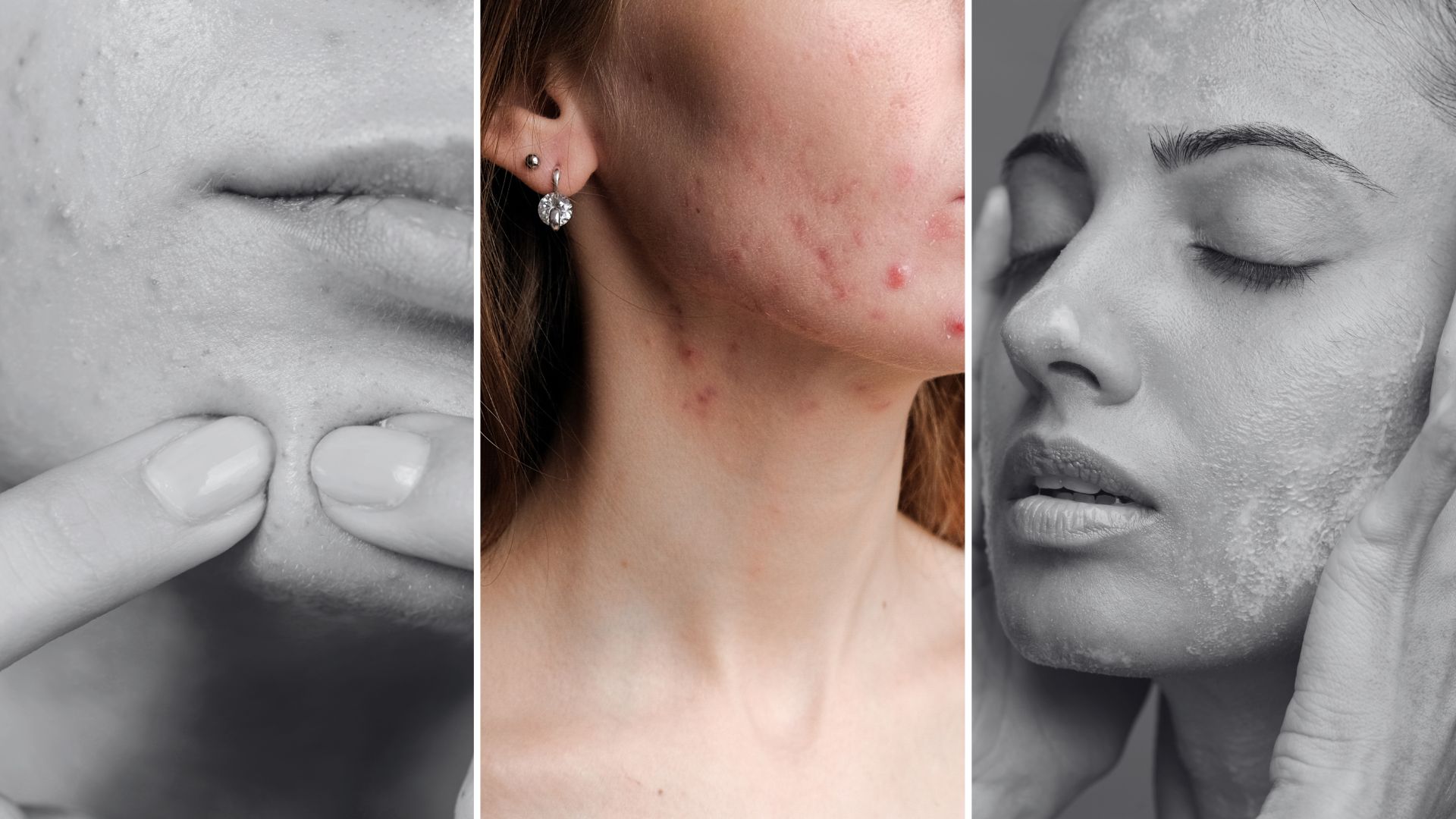 Kosmetyczka czy dermatolog - jak zdecydować gdzie się udać z problemem skórnym?